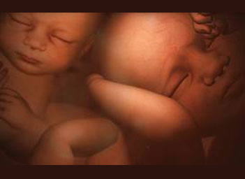 unborn-twins